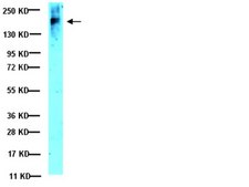 Anti-CFTR Antibody, clone MM13-4 clone MM13-4, Upstate®, from mouse