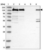 Anti-PLCG1 antibody produced in rabbit Prestige Antibodies® Powered by Atlas Antibodies, affinity isolated antibody, buffered aqueous glycerol solution