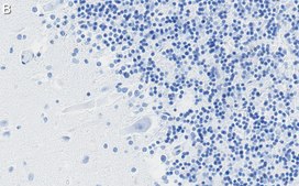 Anti-DNA Polymerase beta Antibody, clone 3F21 ZooMAb® Rabbit Monoclonal recombinant, expressed in HEK 293 cells