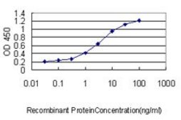 Monoclonal Anti-SQSTM1 antibody produced in mouse clone 2C11, purified immunoglobulin, buffered aqueous solution