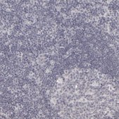 Anti-KIAA1210 antibody produced in rabbit Prestige Antibodies® Powered by Atlas Antibodies, affinity isolated antibody, buffered aqueous glycerol solution