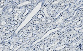 Anti-KIF5B Antibody, clone 2F23 ZooMAb® Rabbit Monoclonal recombinant, expressed in HEK 293 cells