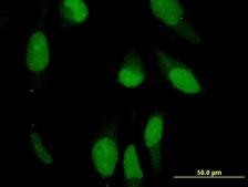 Monoclonal Anti-PRPH antibody produced in mouse clone 3B3, purified immunoglobulin, buffered aqueous solution