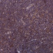 Anti-TCF20 antibody produced in rabbit Prestige Antibodies® Powered by Atlas Antibodies, affinity isolated antibody, buffered aqueous glycerol solution