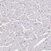 Anti-PPP2R2B antibody produced in rabbit Prestige Antibodies® Powered by Atlas Antibodies, affinity isolated antibody, buffered aqueous glycerol solution