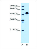 Anti-ATP5B (AB2) antibody produced in rabbit IgG fraction of antiserum