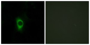 Anti-5-HT-2B antibody produced in rabbit affinity isolated antibody