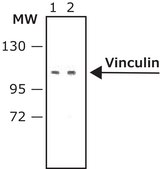 Anti-Vinculin antibody produced in rabbit affinity isolated antibody, buffered aqueous solution