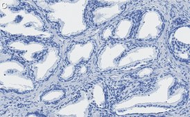 Anti-MIF Antibody, clone 1K16 ZooMAb® Rabbit Monoclonal recombinant, expressed in HEK 293 cells