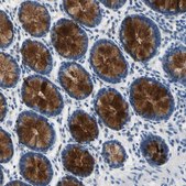 Anti-MUC5B antibody produced in rabbit Prestige Antibodies® Powered by Atlas Antibodies, affinity isolated antibody, buffered aqueous glycerol solution