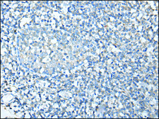 Anti-SPTA1 affinity isolated antibody