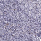 Anti-SLC9A3R2 Prestige Antibodies® Powered by Atlas Antibodies, affinity isolated antibody