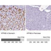 Anti-ATP4B antibody produced in rabbit Prestige Antibodies® Powered by Atlas Antibodies, affinity isolated antibody, buffered aqueous glycerol solution
