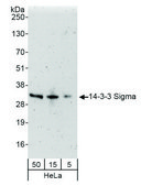 Rabbit anti-14-3-3 Sigma Antibody, Affinity Purified Powered by Bethyl Laboratories, Inc.