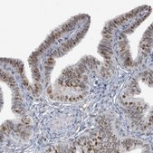 Anti-UCK1 antibody produced in rabbit Prestige Antibodies® Powered by Atlas Antibodies, affinity isolated antibody, buffered aqueous glycerol solution