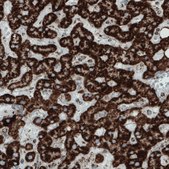 Monoclonal Anti-SDHB antibody produced in mouse Prestige Antibodies® Powered by Atlas Antibodies, clone CL0349, purified immunoglobulin, buffered aqueous glycerol solution