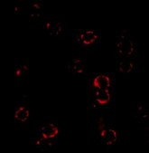 Anti-CXCR4 antibody produced in rabbit affinity isolated antibody