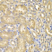 Anti-XIAP antibody produced in rabbit