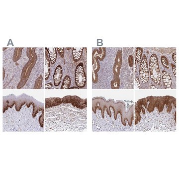 Anti-ITGA2 antibody produced in rabbit Prestige Antibodies® Powered by Atlas Antibodies, affinity isolated antibody, buffered aqueous glycerol solution