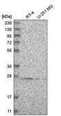 Anti-HSCB antibody produced in rabbit Prestige Antibodies® Powered by Atlas Antibodies, affinity isolated antibody