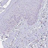 Anti-CYBB antibody produced in rabbit Prestige Antibodies® Powered by Atlas Antibodies, affinity isolated antibody, buffered aqueous glycerol solution