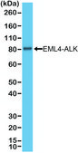 Anti-ALK antibody, Rabbit monoclonal recombinant, expressed in HEK 293 cells, clone RM361, purified immunoglobulin