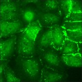 A549 Cells GFP-CTNNB1 RFP-LMNB1