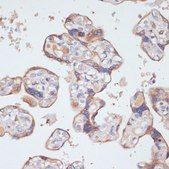 Anti-BDNF antibody produced in rabbit