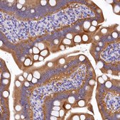 Anti-EPS8L2 antibody produced in rabbit Prestige Antibodies® Powered by Atlas Antibodies, affinity isolated antibody, buffered aqueous glycerol solution