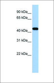 Anti-GATA3 antibody produced in rabbit affinity isolated antibody