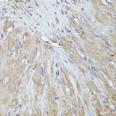 兔源抗-c-Fos抗体