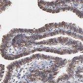 Anti-CHM antibody produced in rabbit Prestige Antibodies® Powered by Atlas Antibodies, affinity isolated antibody, buffered aqueous glycerol solution