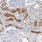 Anti-SLC22A12 antibody produced in rabbit Prestige Antibodies® Powered by Atlas Antibodies, affinity isolated antibody, buffered aqueous glycerol solution
