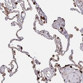 Anti-ACACA antibody produced in rabbit Prestige Antibodies® Powered by Atlas Antibodies, affinity isolated antibody, buffered aqueous glycerol solution