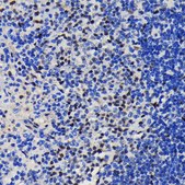 Anti-KAP1/TRIM28 antibody produced in rabbit