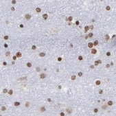Anti-TERF2 antibody produced in rabbit Ab1, Prestige Antibodies® Powered by Atlas Antibodies, affinity isolated antibody, buffered aqueous glycerol solution