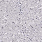 Anti-CASQ1 antibody produced in rabbit Prestige Antibodies® Powered by Atlas Antibodies, affinity isolated antibody, buffered aqueous glycerol solution