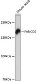 Anti-FANCD2 Antibody, clone 7U2D6, Rabbit Monoclonal