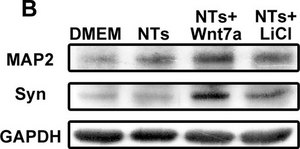 Anti-Microtubule-Associated Protein 2 (MAP2) Antibody Chemicon®, from rabbit