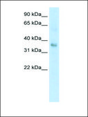 Anti-TGFB1 affinity isolated antibody