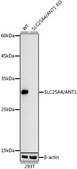 [KO Validated]Anti-SLC25A4/ANT1 Antibody, clone 3C1Q3, Rabbit Monoclonal