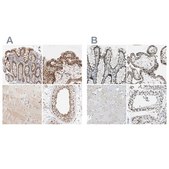 Anti-GATAD2A antibody produced in rabbit Prestige Antibodies® Powered by Atlas Antibodies, affinity isolated antibody, buffered aqueous glycerol solution