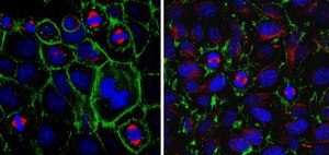 抗PPAR-γ抗体 from rabbit, purified by affinity chromatography