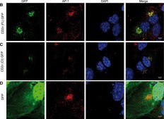 Monoclonal Anti-γ-Adaptin antibody produced in mouse clone 100/3, ascites fluid
