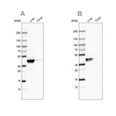Anti-ACAT1 antibody produced in rabbit Prestige Antibodies® Powered by Atlas Antibodies, affinity isolated antibody, buffered aqueous glycerol solution