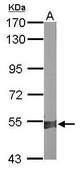 Anti-ALDH1A2 antibody produced in rabbit affinity isolated antibody, buffered aqueous solution