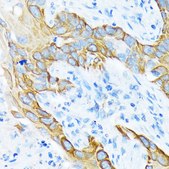 Anti-Cytokeratin 4 (KRT4) Antibody, clone 6H9R6, Rabbit Monoclonal