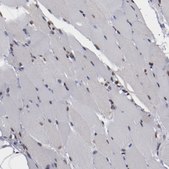 Anti-AKT1 antibody produced in rabbit Prestige Antibodies® Powered by Atlas Antibodies, affinity isolated antibody, buffered aqueous glycerol solution