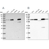 Anti-GBE1 antibody produced in rabbit Prestige Antibodies® Powered by Atlas Antibodies, affinity isolated antibody, buffered aqueous glycerol solution