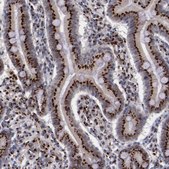 Anti-GOLIM4 antibody produced in rabbit Ab2, Prestige Antibodies® Powered by Atlas Antibodies, affinity isolated antibody, buffered aqueous glycerol solution